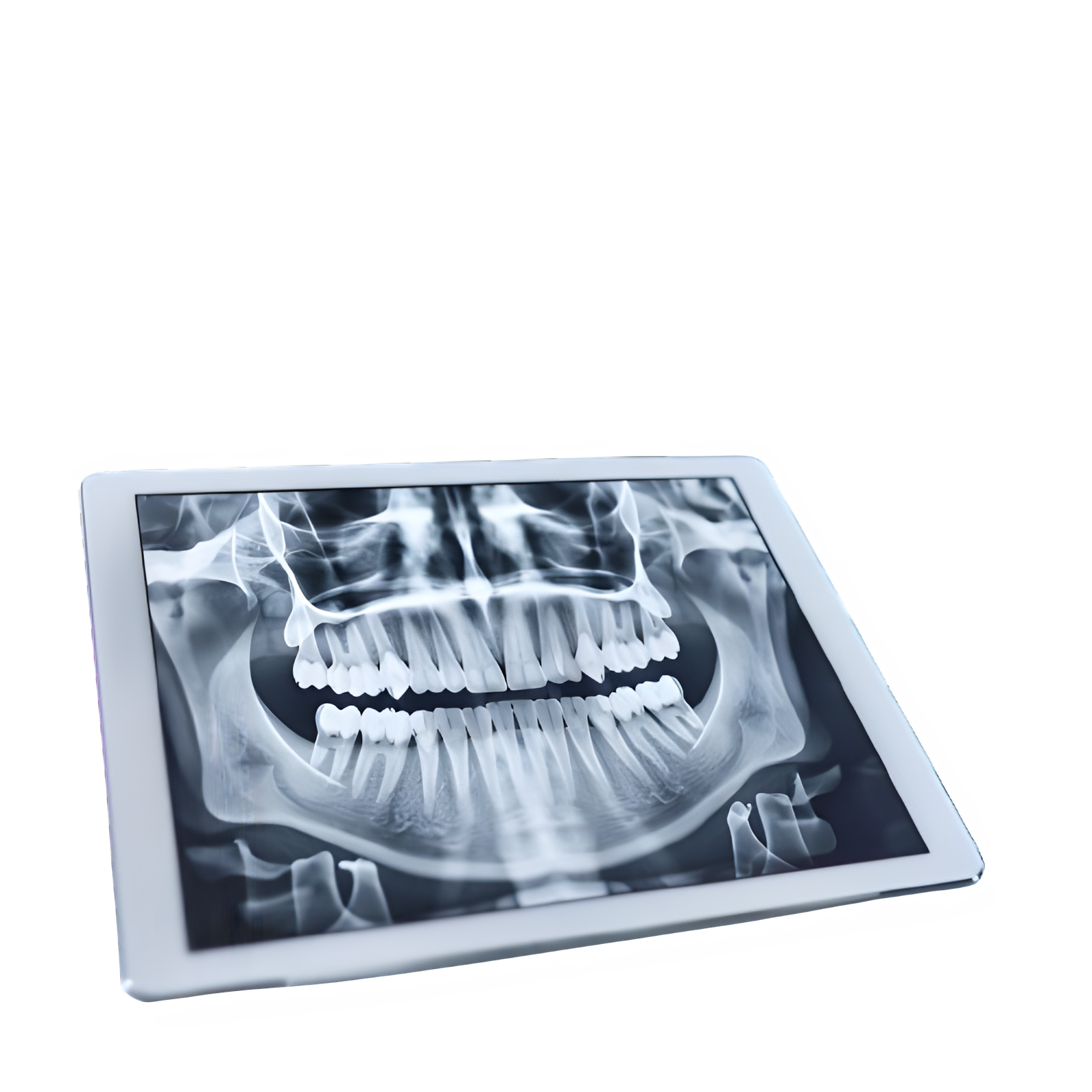 implantes dentales sevilla