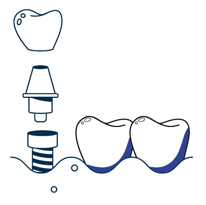 Dentistry Flat Icons Infographics