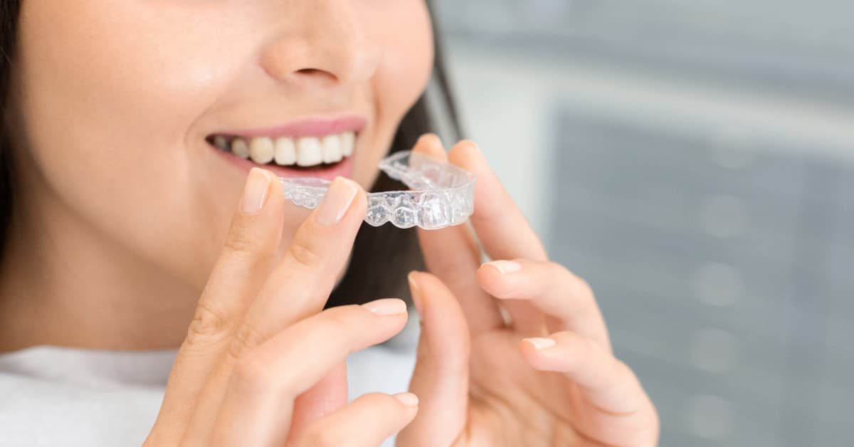 Mujer sonriendo mientras se coloca una férula de ortodoncia invisible tipo invisalign en una clínica dental.